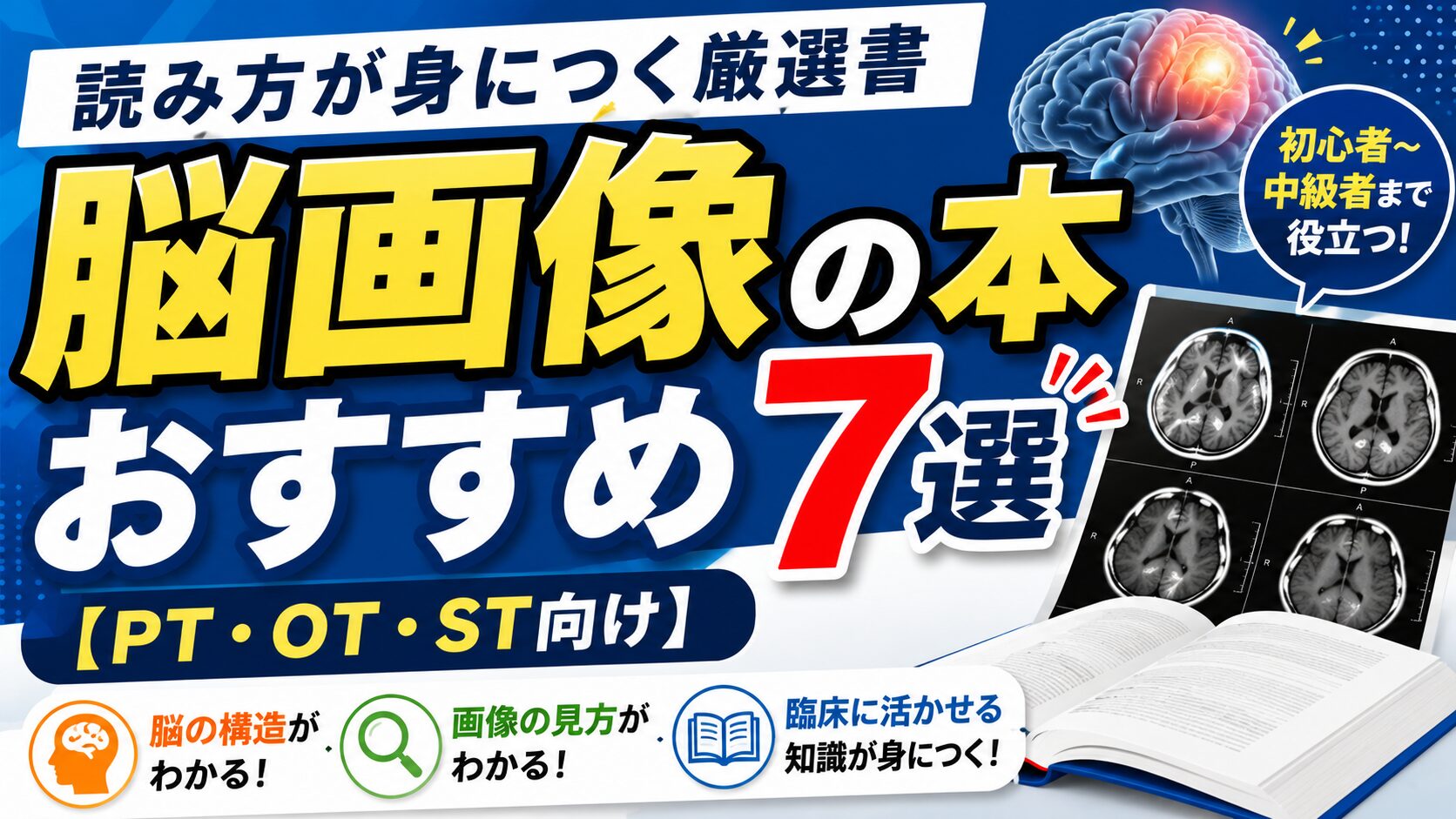 脳画像の本おすすめ7選【PT・OT・ST向け】読み方が身につく厳選書